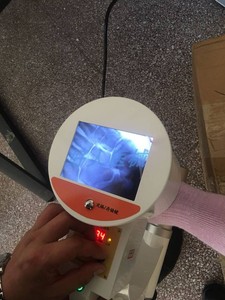 正骨便携x射线机手提式x光机透视仪骨科元器件线路焊接点检测