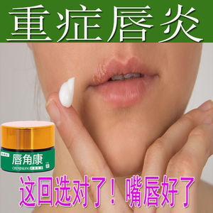 口唇炎唇膏修复专用药膏嘴唇干裂脱皮起皮上火起泡裂口嘴角润唇油