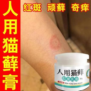 人得猫癣人用猫藓外用药人患猫狗癣真菌皮肤病瘙痒红斑止痒外用膏