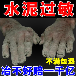 手藓膏真菌蜕皮