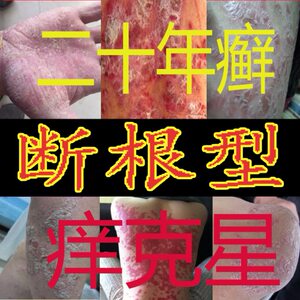 【银癣迪】银癣迪品牌,价格 - 阿里巴巴
