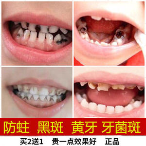 儿童牙膏防蛀牙可吞咽3一6一12岁以上去牙齿黑牙菌斑祛除神器正品