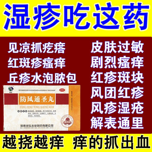 防风通圣丸治湿疹的药过敏皮肤瘙痒止痒清热解毒皮肤疙瘩红疹治痒