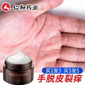 手脱皮霜抑菌膏季节性褪皮手掌严重专用蜕皮裂手上起皮干燥掉皮足