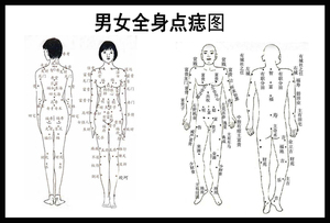 男女全身点痣挂图海报祛痣身体取痣去痣美容店除痣装饰画kt板定做