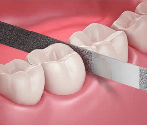 牙齿磨平器打磨条