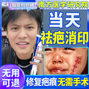 祛疤膏去疤痕修复除疤烫伤伤疤去除淡化淡疤印黑印黑色素沉淀沉着