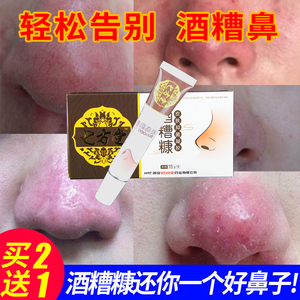 酒糟鼻修复鼻子红肿凝胶去红血丝红鼻头软膏鼻螨清祛螨虫粉刺男士