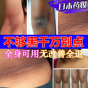 去除黑色素膝盖