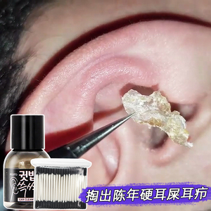 耳屎软化剂