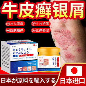 日本治疗神经性皮炎去根除脂溢皮炎外用膏生物制剂可善挺牛皮癣藓