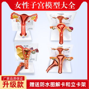 女性人体子宫解剖模型教具妇科双侧卵巢病理教学模具生殖正常病变