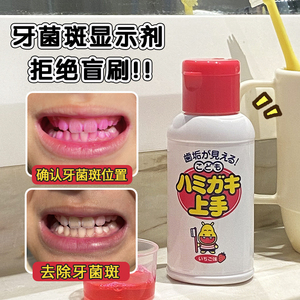 日本丹平牙菌斑显示剂祛除显色剂儿童去牙垢神器菌斑染色剂指示剂
