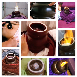 温阳罐火灸温灸