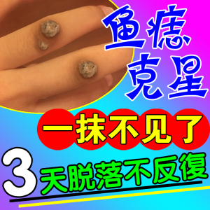 鱼鳞痣药膏扁皮疣点疣手指长疣石疣趾疣去除膏疣瘊克星拓疣专用药