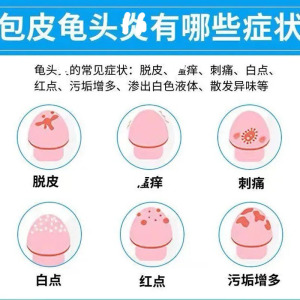 龟头炎霉菌性包皮炎膏珍珠疹白垢冠状沟红点阴茎痒男性喷剂药柜膏
