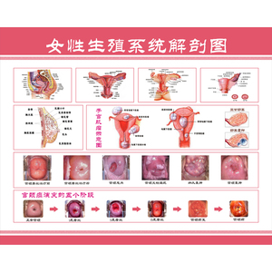 女性生殖器解剖图 医院宣传海报挂图 妇科知识海报宫颈疾病示意图