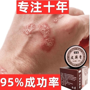 老专家药膏真菌治疗瘙痒手足皮肤病牛皮癣药膏中药外用克星专业去