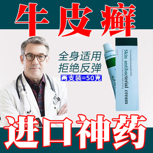 顽固廯牛皮癣藓银屑病皮肤特效药埃及进口湿疹手足藓股癣外用药膏