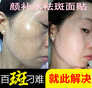 御尚坊护肤品颜面膜 祛斑补水保湿晒后修复塑造小v脸贴片面膜男女