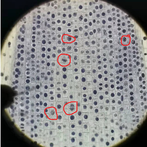 洋葱根尖分生区细胞图图片