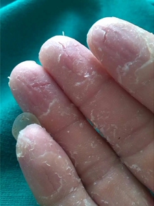 干裂修复霜龟裂皲裂护手指足裂口防裂脚底开裂凡士林马油膏77人付款