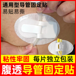 腹透导管固定贴 picc导管固定装置 尿管膀胱造瘘引流管固定保护贴