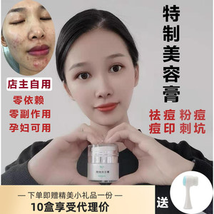 去痘膏去痘印痘疤痘坑毛孔粉刺黑头学生青春痘男女特制美容膏正品