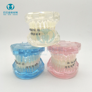 牙科正畸模型 4种托槽对比模型 金属 陶瓷舌侧自锁托槽示范模型