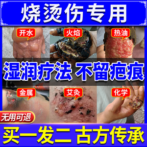 獾油烫伤膏烧烫伤外用皮肤湿润正品婴儿獾子油烫伤油狗油烫伤膏药