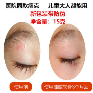 美国正品进口除双眼皮手术去疤痕灵儿童硅凝胶凹凸增生修复祛疤膏