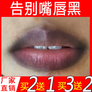 改善唇周黑唇膏嘴角发黑去除嘴唇周边发黑去唇角边黑嘴角暗沉唇部