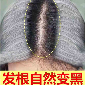 白发变黑发神器少中老年白头发克星少白头产后白发转黑植物乌发液