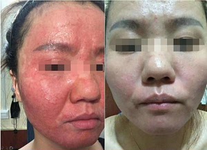 激素脸克星,地龙多肽精华液,核心成分是威廉环毛蚓提取物,想要