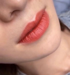 纹发际线半永久