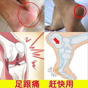 足跟痛贴足底筋膜膏足跟痛康贴宁消贴跟骨脚后跟疼痛安康膏筋痛舒