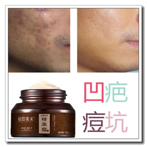 豆印豆坑修复去除凹陷痘疤祛眼角抓伤疤痕灵面膜激光修护痘坑痘印