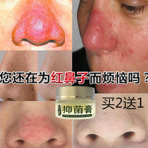 去红血丝草莓鼻