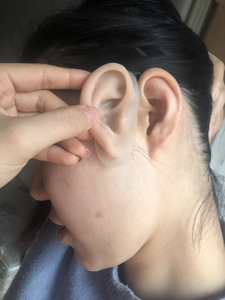 假耳朵仿真义耳硅胶