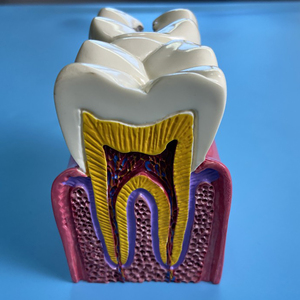 医患沟通模型牙科模型横截面分解牙与正常对比牙模牙科诊所摆件