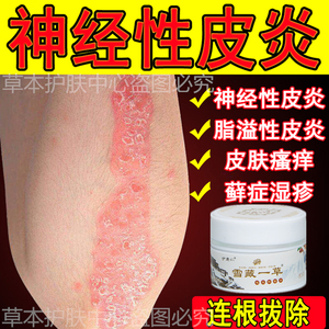 去根皮肤瘙痒抑菌药膏顽固皮炎皮疹过敏红疹速肤康外用膏田妹子丶