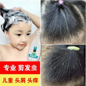 去卷发虫专业除吃发虫儿童去屑止痒抗真菌除螨虫剪发虫洗发水女童