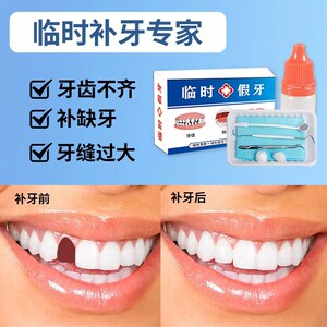 自己临时补牙洞假牙牙缝门牙缺补牙自制牙套粘牙胶水材料(超硬款)