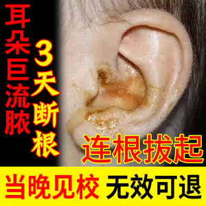 中耳炎滴耳液流脓人用专用药洗耳液治疗油耳朵烂痒可除根耳鸣耳痛