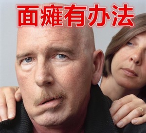 面瘫按摩器 老人震动脸部康复中风偏瘫后遗症按摩器手动电动面部