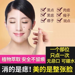 去痣点痣无痕正品水点痣膏祛痣点斑水神器笔药脸部美容院专用仪液