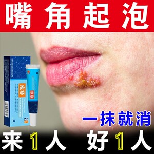 口角炎药膏嘴角起泡烂嘴角起水泡嘴巴浓疮嘴巴上火口角红肿发痒溃