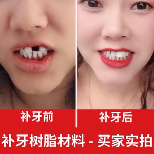 临时假牙套牙仿真牙齿自补材料假牙齿搞笑牙龈萎缩牙缝填充贴片修