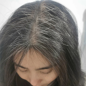 【广药白云山】白发三千丈 缘愁似个长 不做白发女郎 白发没了