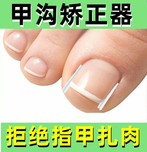 【指甲往肉里长】指甲往肉里长品牌,价格 - 阿里巴巴